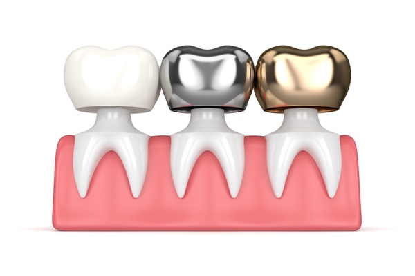 When Is Getting A Dental Crown Necessary?