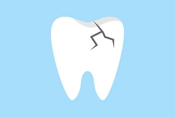 General Dentistry Treatments for a Damaged Tooth from New Image Dentistry in Franklin, TN