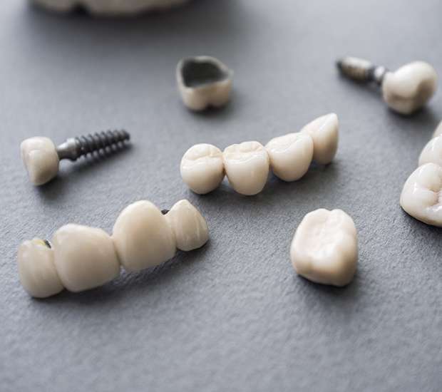 Franklin The Difference Between Dental Implants and Mini Dental Implants