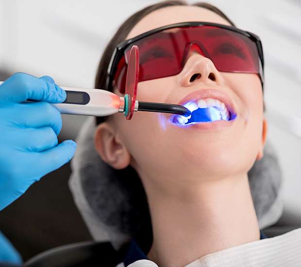 Franklin Professional Teeth Whitening